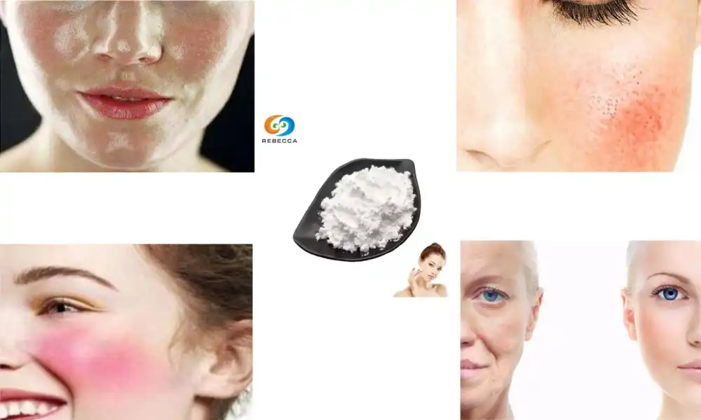 What skin types benefit most from L ergothioneine?